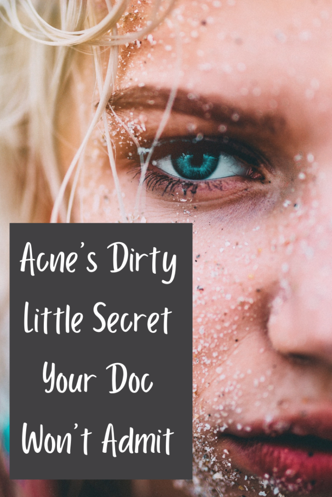 There's a big problem with how we treat acne today, and it's wrapped up in acne's little secret your doctors won't admit. 